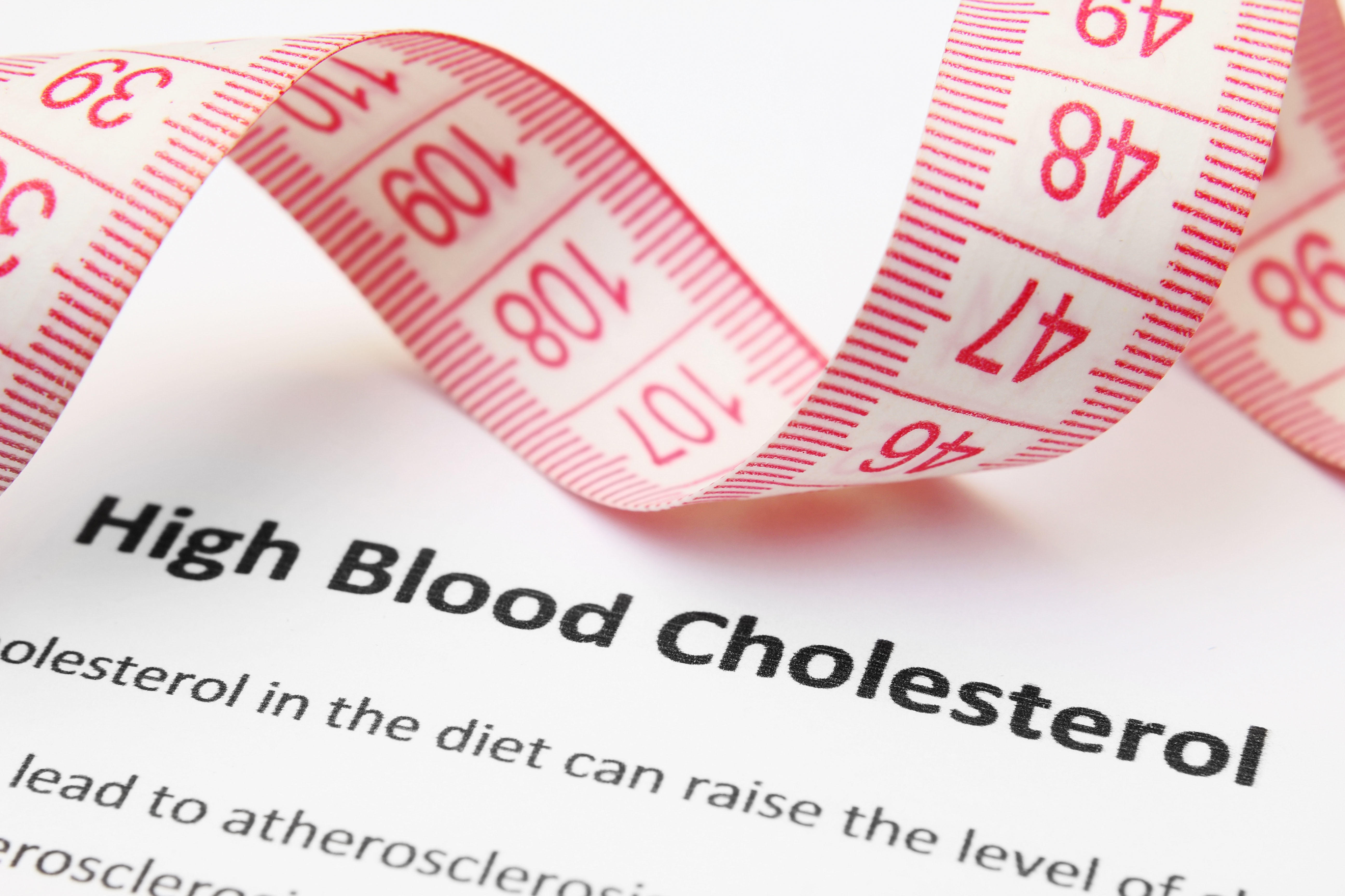 Gros plan d'un ruban à mesurer sur du papier sur lequel est écrit "High Blood Cholesterol". Cholestérol sanguin élevé