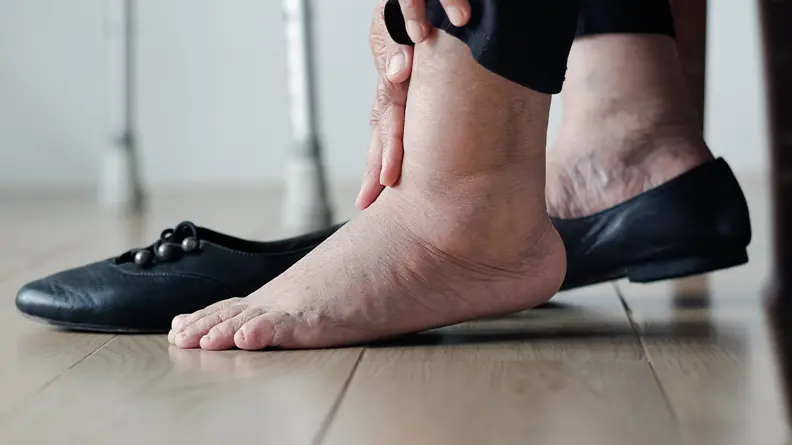 Close-up of an elderly person's hand and feet. The person is putting on black shoes. Their feet and ankles are swollen.